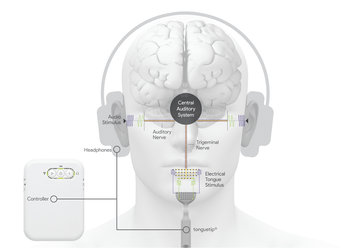 photo du fonctionnement de Neuromod Devices